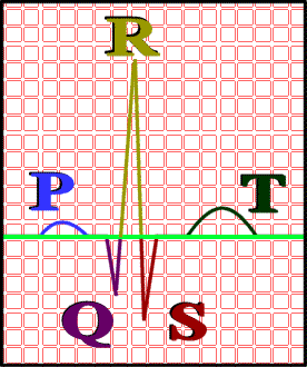 P, Q, R, S, and T waves